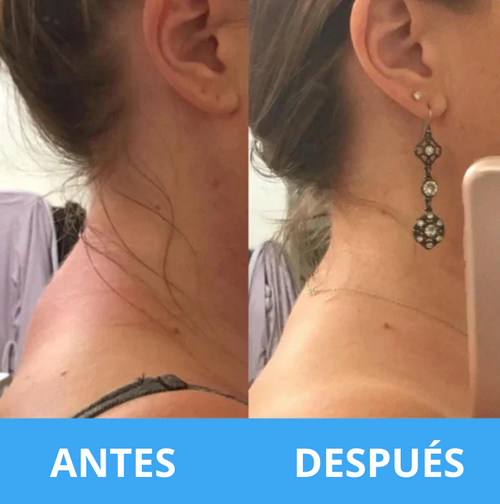 Vibroslim Body Massager™ - Dispositivo para el alivio del dolor crónico - De Shopping Store